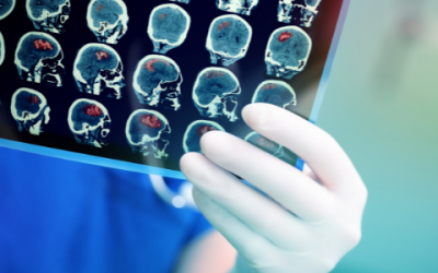 Impact of hydroxytyrosol on stroke: tracking therapy response on neuroinflammation and cerebrovascular parameters using PET-MR imaging and on functional outcomes